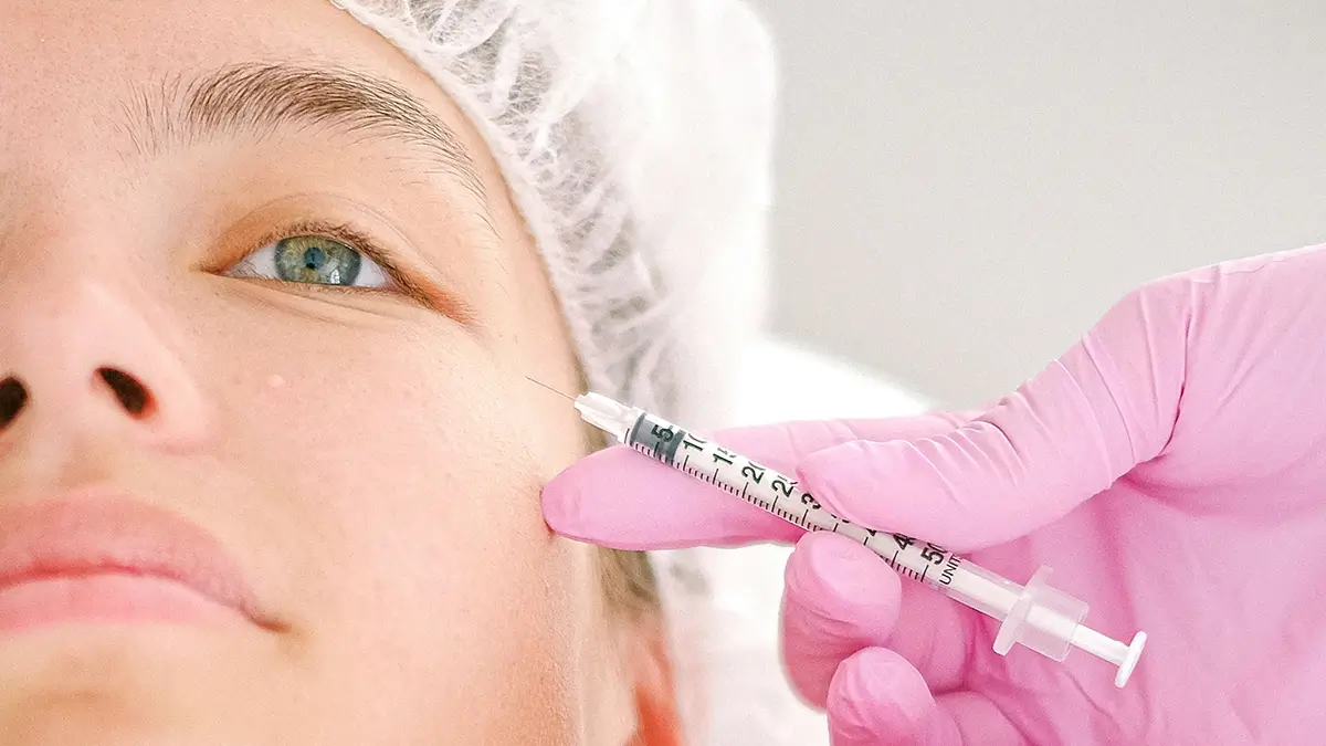 Удаление мимических морщин на скулах специалистом